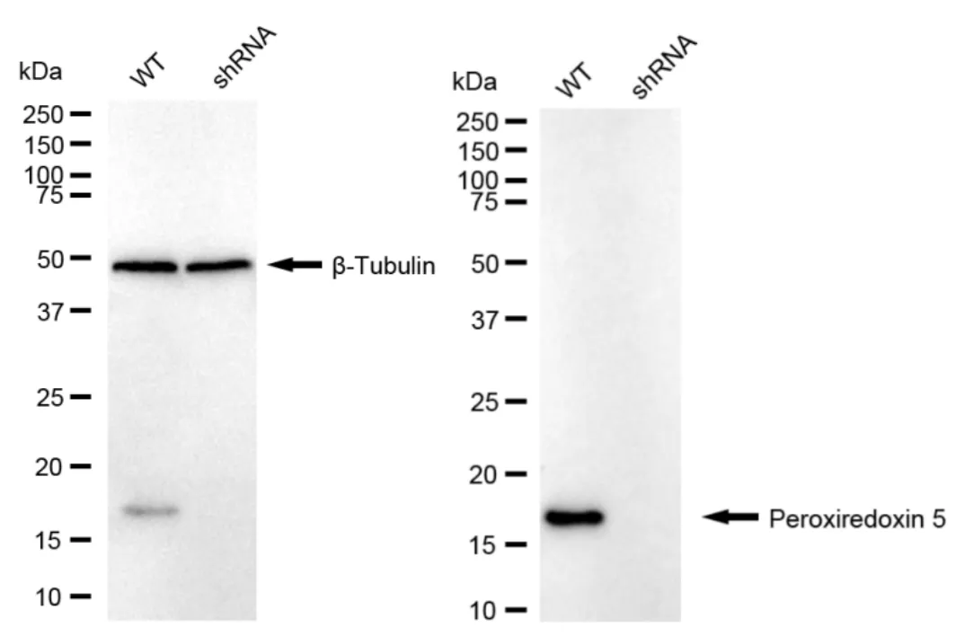 KD-Validated Peroxiredoxin 5 Recombinant Rabbit Monoclonal Antibody