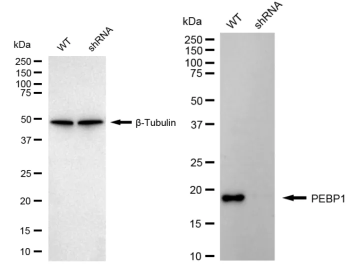 KD-Validated PBP Recombinant Rabbit Monoclonal Antibody