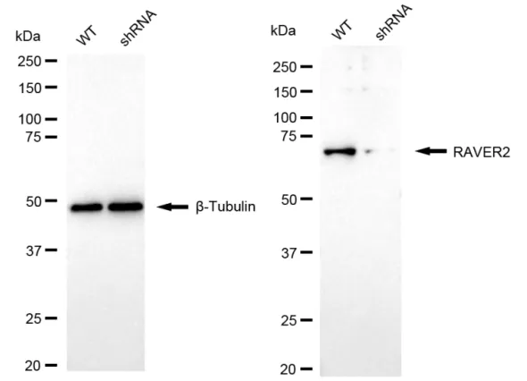 KD-Validated RAVER2 Recombinant Rabbit Monoclonal Antibody