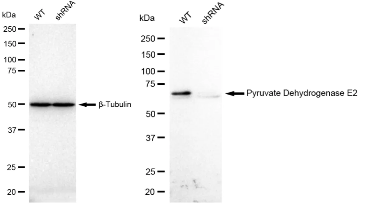 KD-Validated Pyruvate Dehydrogenase E2 Recombinant Rabbit Monoclonal Antibody