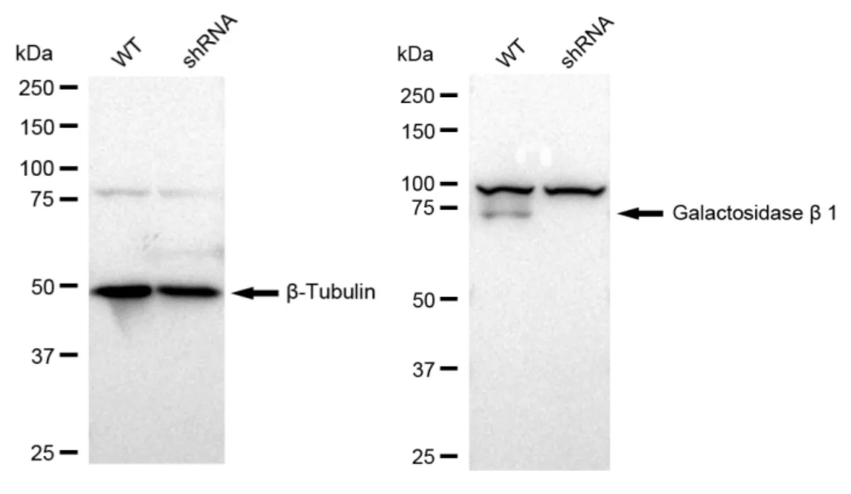 KD-Validated Galactosidase Beta 1 Recombinant Rabbit Monoclonal Antibody
