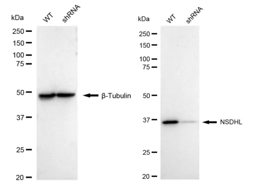 KD-Validated NSDHL Recombinant Rabbit Monoclonal Antibody