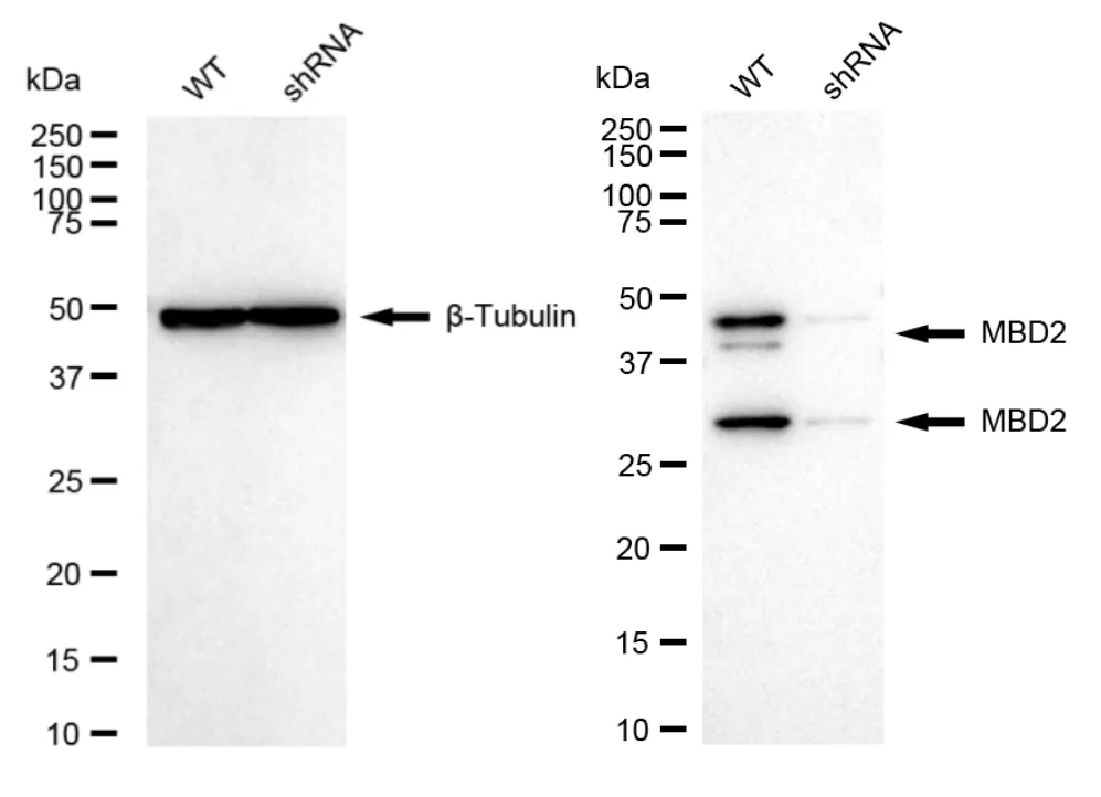 KD-Validated Methyl-CpG Binding Domain Protein 2 Recombinant Rabbit Monoclonal Antibody