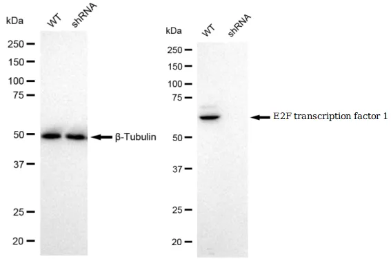 KD-Validated E2F Transcription Factor 1 Recombinant Rabbit Monoclonal Antibody