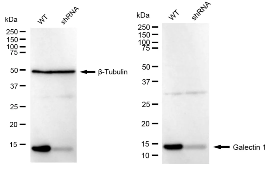 KD-Validated Galectin 1 Recombinant Rabbit Monoclonal Antibody