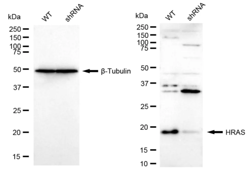 KD-Validated HRAS Recombinant Rabbit Monoclonal Antibody