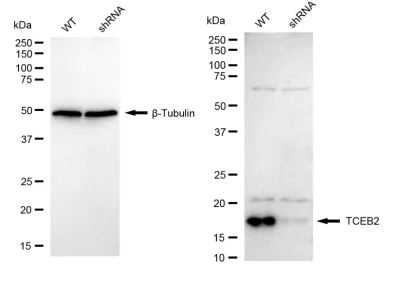 KD-Validated TCEB2 Recombinant Rabbit Monoclonal Antibody