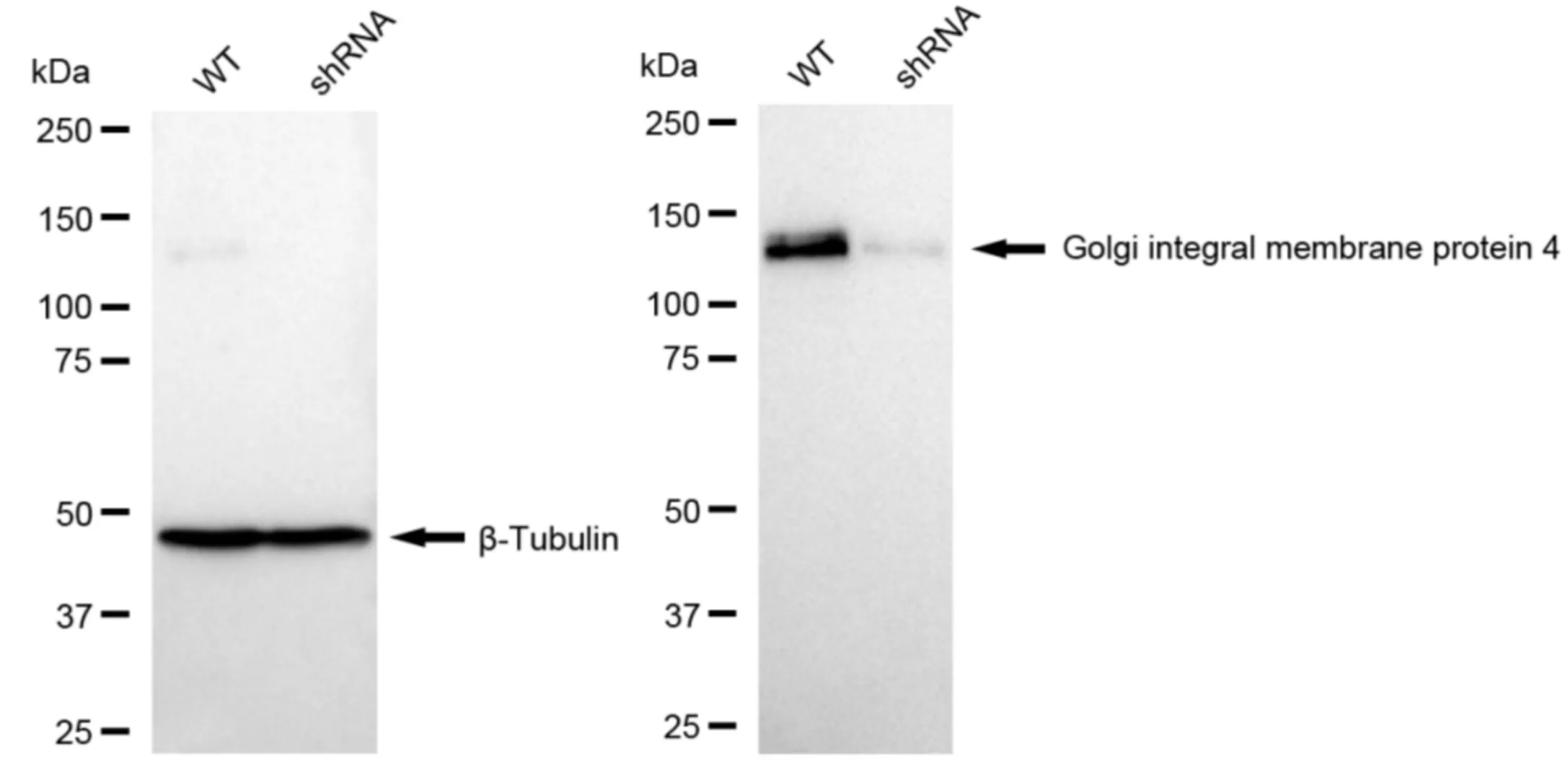 KD-Validated Golgi Integral Membrane Protein 4 Recombinant Rabbit Monoclonal Antibody