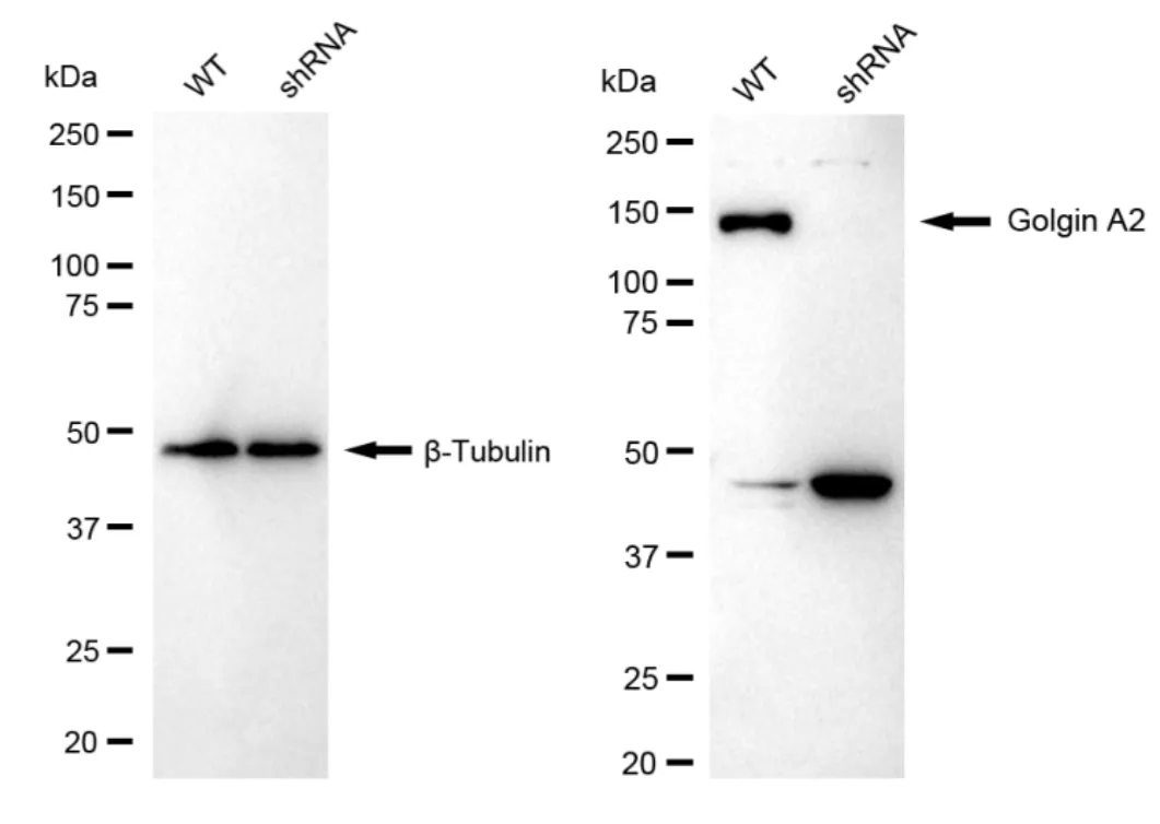 KD-Validated Golgin A2 Recombinant Rabbit Monoclonal Antibody