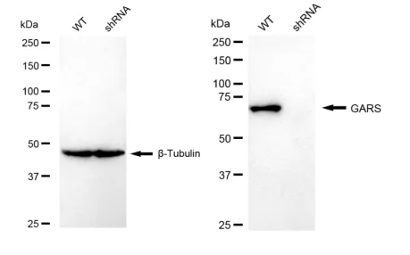 KD-Validated GARS Recombinant Rabbit Monoclonal Antibody