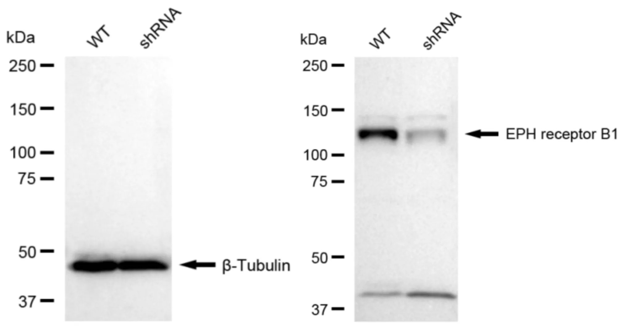 KD-Validated Eph Receptor B1 Recombinant Rabbit Monoclonal Antibody
