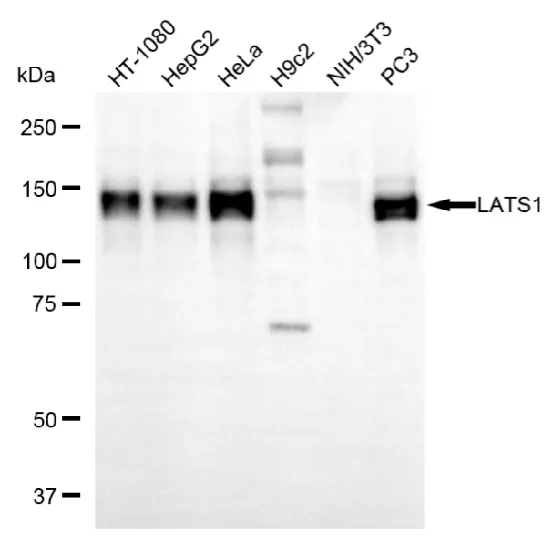 WesternBlot(WB) - KD-Validated LATS1 Mouse Oligoclonal Antibody KVAb01094