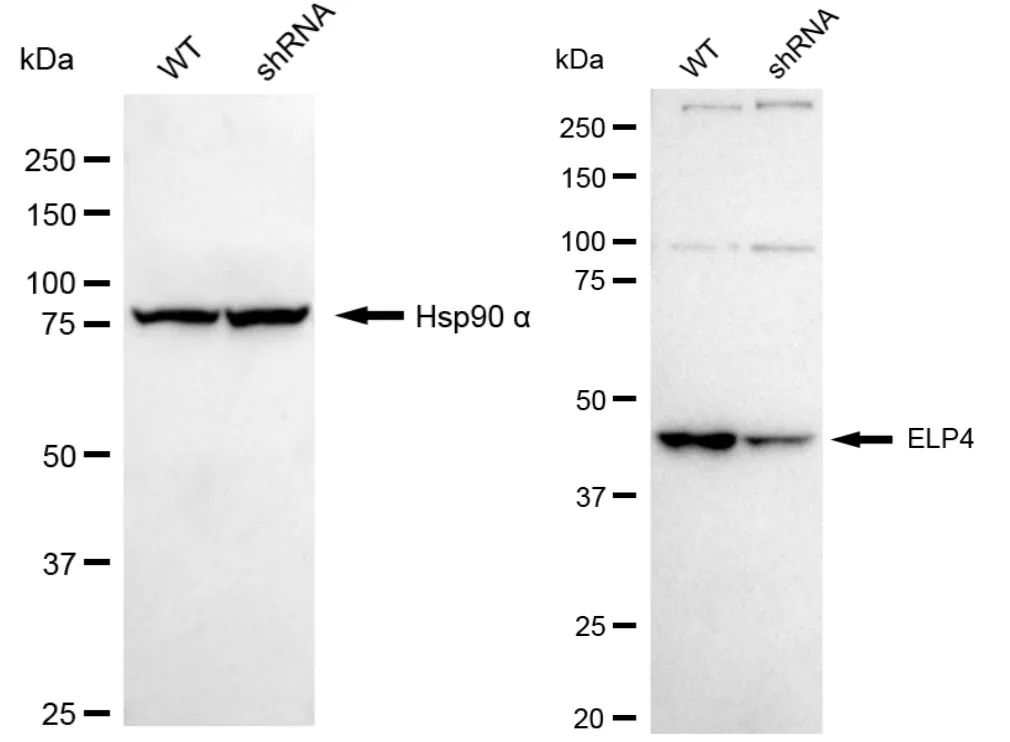 KD-Validated ELP4 Recombinant Rabbit Monoclonal Antibody