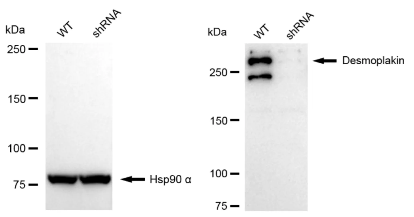 KD-Validated Desmoplakin Recombinant Rabbit Monoclonal Antibody