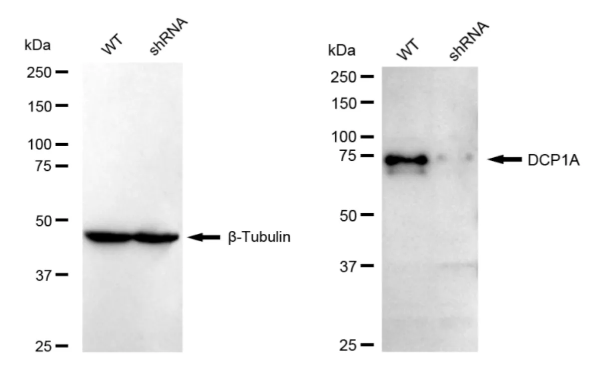 KD-Validated DCP1A Recombinant Rabbit Monoclonal Antibody