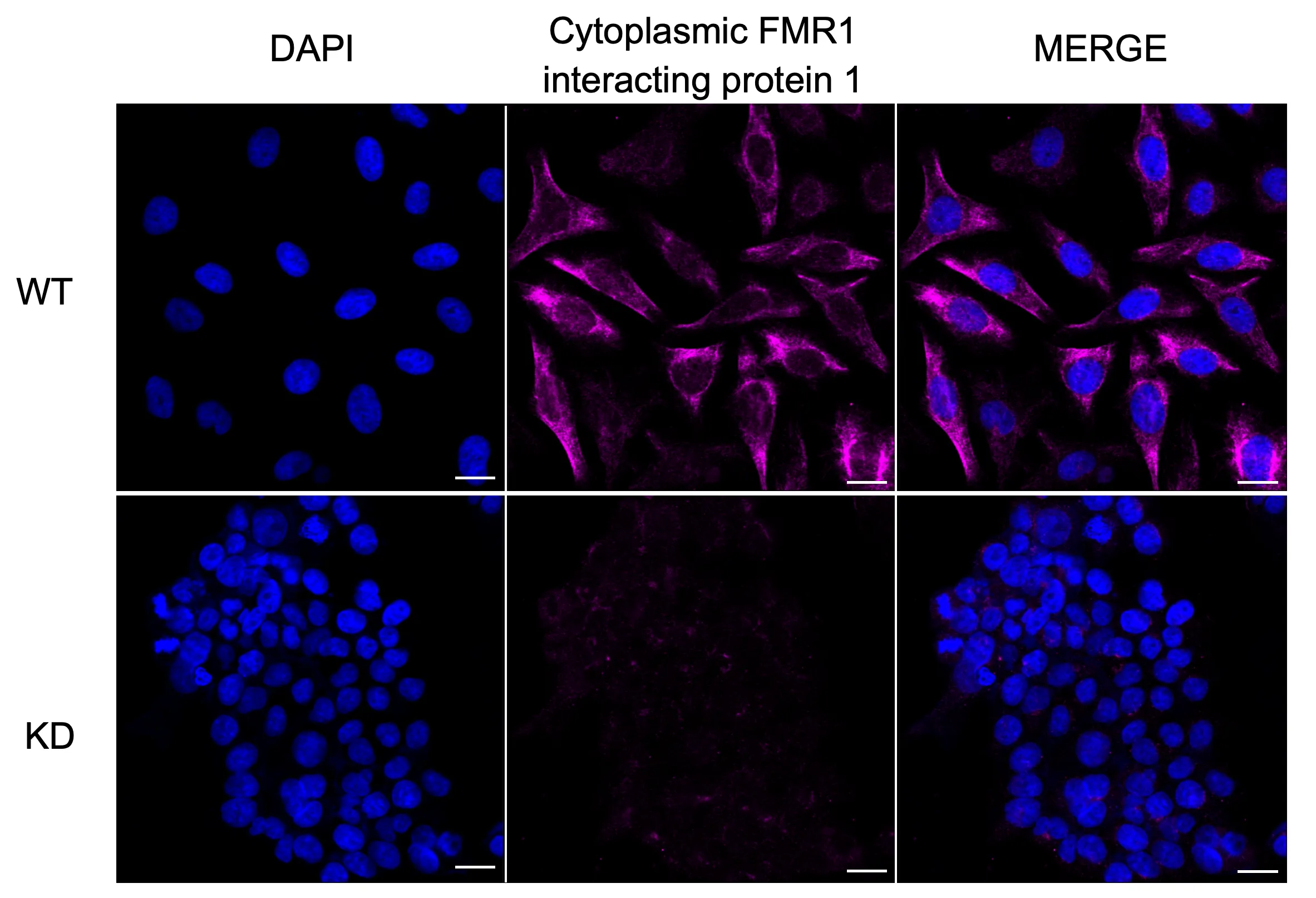 Immunocytochemistry(ICC) - KD-Validated Cytoplasmic Fmr1 Interacting Protein 1 Recombinant Rabbit Monoclonal Antibody KVAb01117