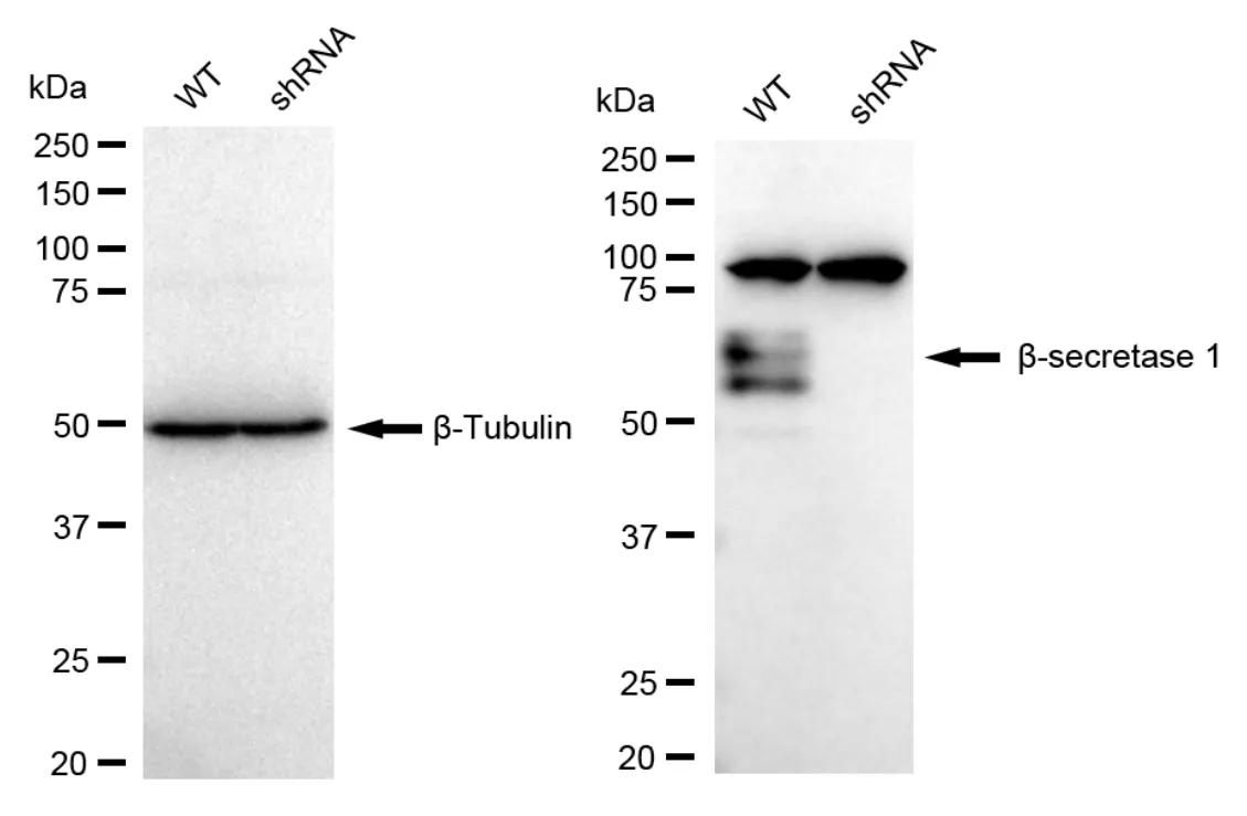 KD-Validated Beta-Secretase 1 Recombinant Rabbit Monoclonal Antibody