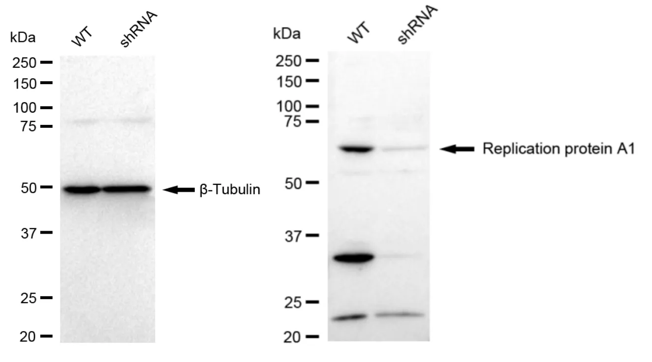 KD-Validated Replication Protein A1 Recombinant Rabbit Monoclonal Antibody
