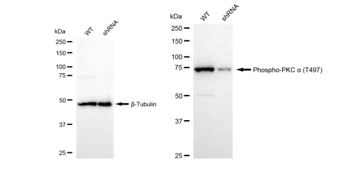 KD-Validated Phospho-PKC Alpha (T497) Recombinant Rabbit Monoclonal Antibody