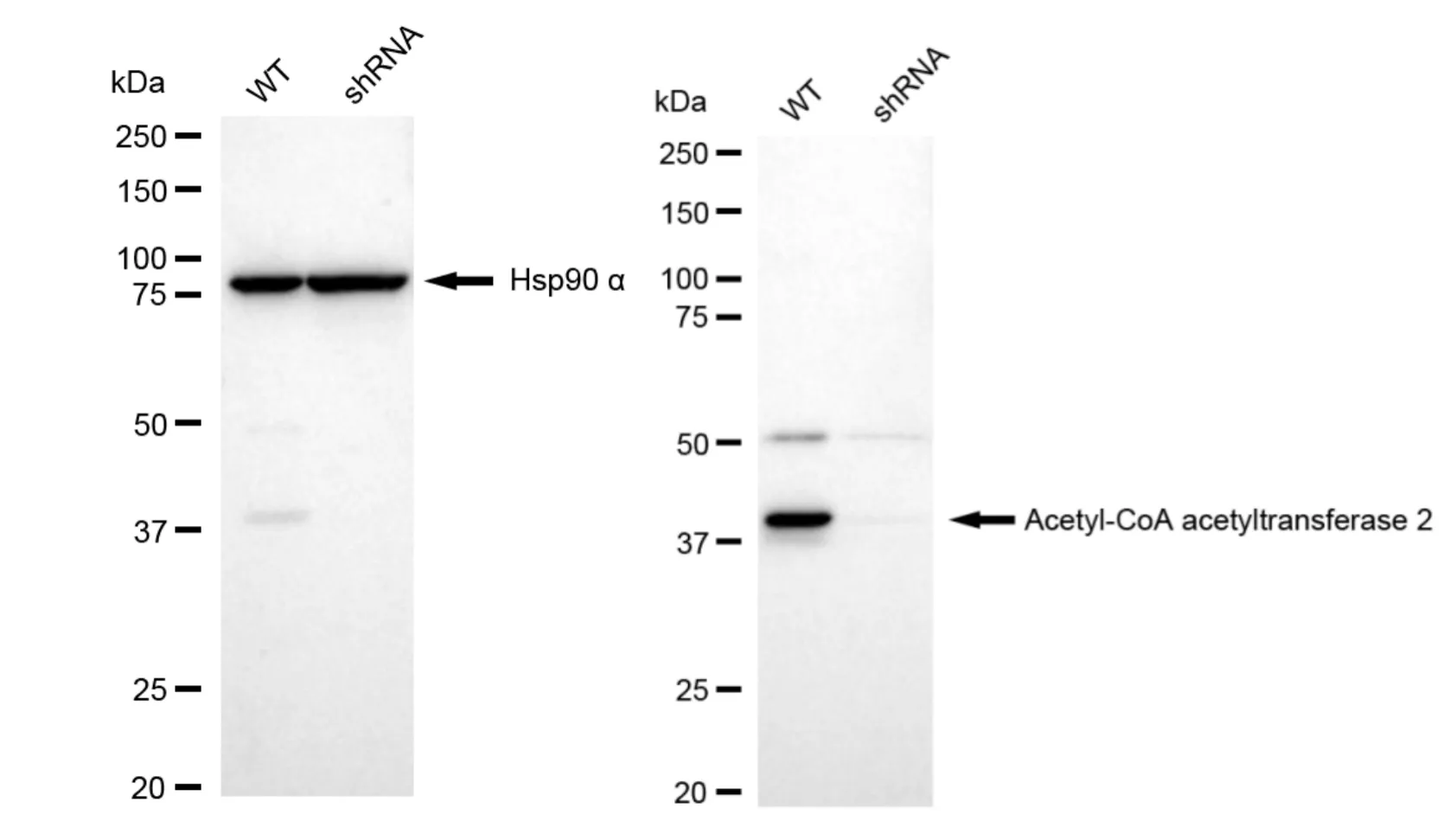 KD-Validated Acetyl-CoA Acetyltransferase 2 Recombinant Rabbit Monoclonal Antibody