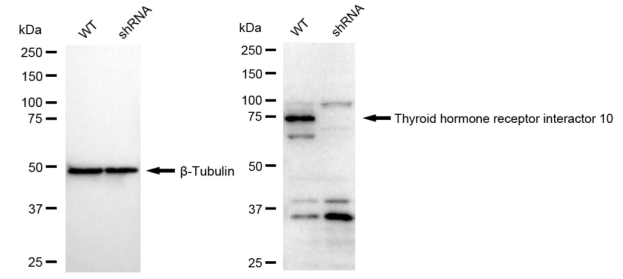 KD-Validated Thyroid Hormone Receptor Interactor 10 Recombinant Rabbit Monoclonal Antibody