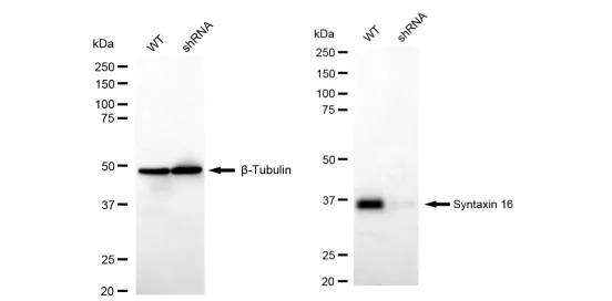 KD-Validated Syntaxin 16 Recombinant Rabbit Monoclonal Antibody