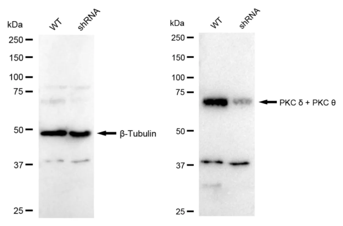 KD-Validated PKC Delta + PKC Theta Recombinant Rabbit Monoclonal Antibody