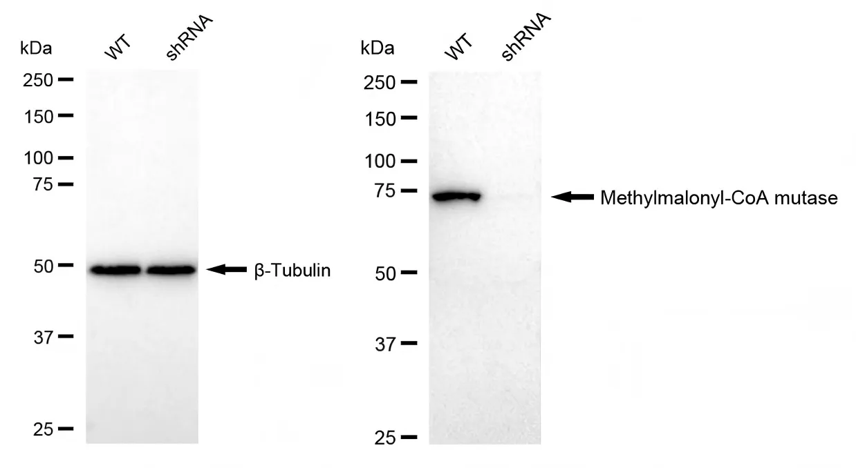 KD-Validated Methylmalonyl-CoA mutase Recombinant Rabbit Monoclonal Antibody