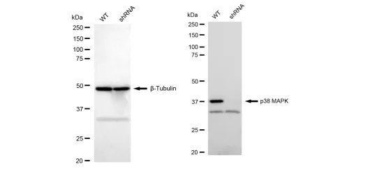 KD-Validated p38 MAPK Recombinant Rabbit Monoclonal Antibody