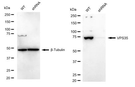 KD-Validated VPS35 Recombinant Rabbit Monoclonal Antibody