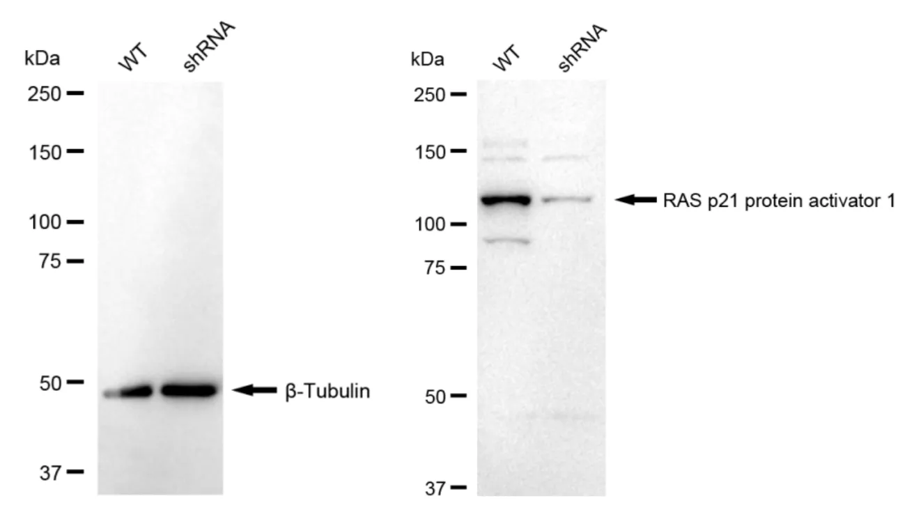 KD-Validated RAS P21 Protein Activator 1 Recombinant Rabbit Monoclonal Antibody