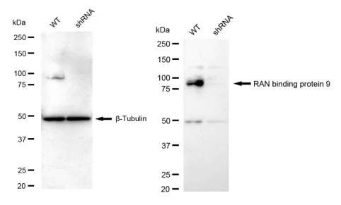 KD-Validated RAN Binding Protein 9 Recombinant Rabbit Monoclonal Antibody