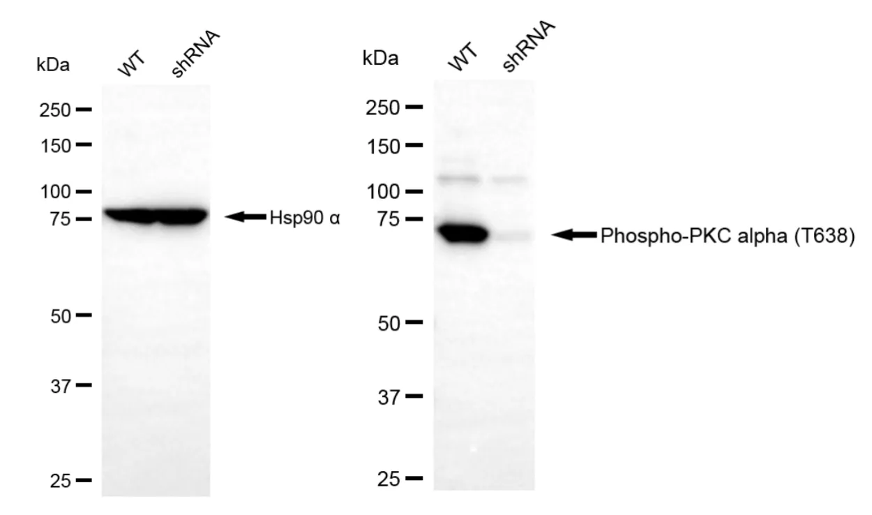 KD-Validated Phospho-PKC Alpha (T638) Recombinant Rabbit Monoclonal Antibody