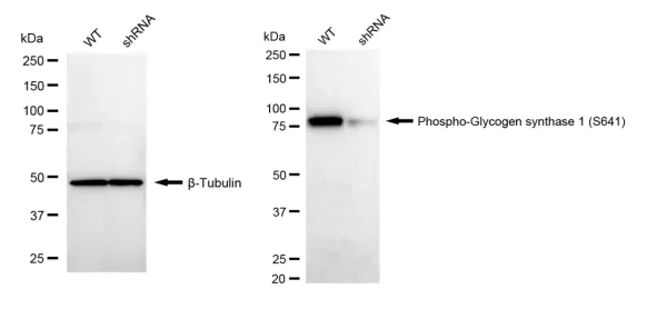 KD-Validated Phospho-Glycogen Synthase 1 (S641) Recombinant Rabbit Monoclonal Antibody