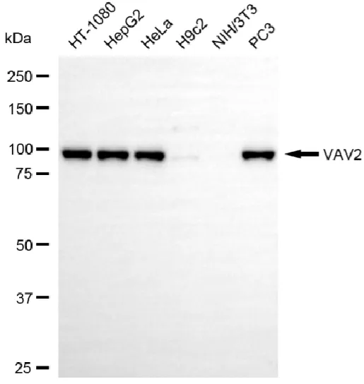 WesternBlot(WB) - KD-Validated VAV2 Recombinant Rabbit Monoclonal Antibody KVAb01332