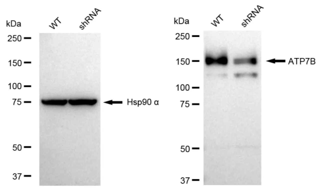 KD-Validated ATP7B Recombinant Rabbit Monoclonal Antibody