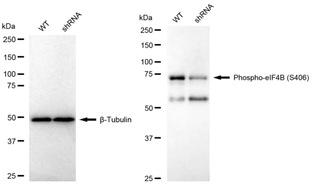 KD-Validated Phospho-eIF4B (S406) Recombinant Rabbit Monoclonal Antibody