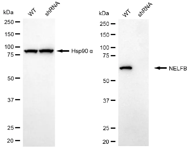 KD-Validated NELFB Recombinant Rabbit Monoclonal Antibody