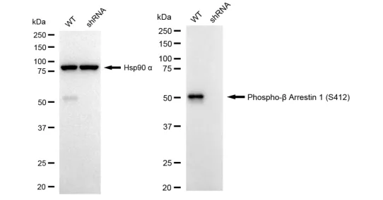 KD-Validated Phospho-Beta Arrestin 1 (S412) Recombinant Rabbit Monoclonal Antibody