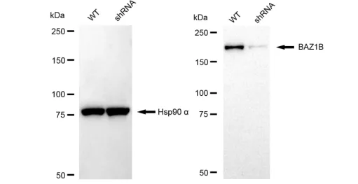 KD-Validated BAZ1B Recombinant Rabbit Monoclonal Antibody