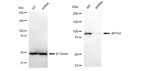 KD-Validated AP1G1 Recombinant Rabbit Monoclonal Antibody