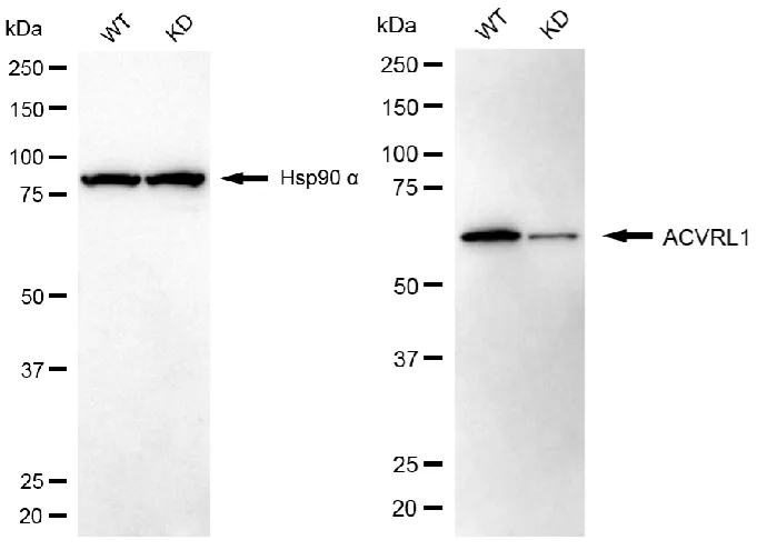 KD-Validated Activin A Receptor Like Type 1 Recombinant Rabbit Monoclonal Antibody