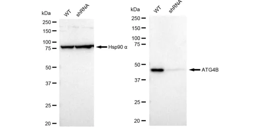KD-Validated ATG4B Recombinant Rabbit Monoclonal Antibody