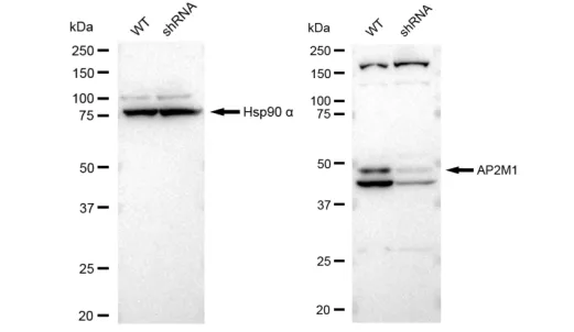KD-Validated AP2M1 Recombinant Rabbit Monoclonal Antibody