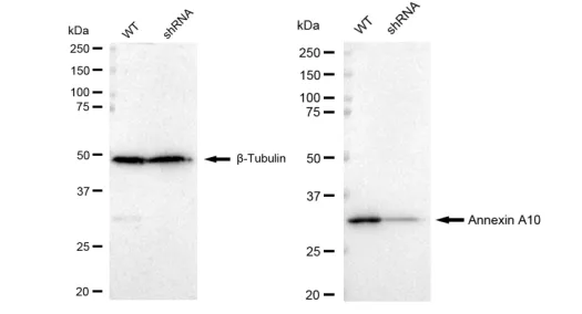 KD-Validated Annexin A10 Recombinant Rabbit Monoclonal Antibody