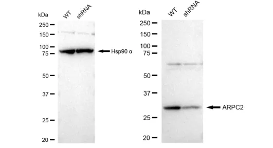 KD-Validated ARPC2 Recombinant Rabbit Monoclonal Antibody