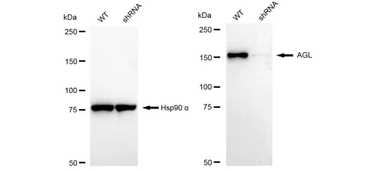 KD-Validated AGL Recombinant Rabbit Monoclonal Antibody