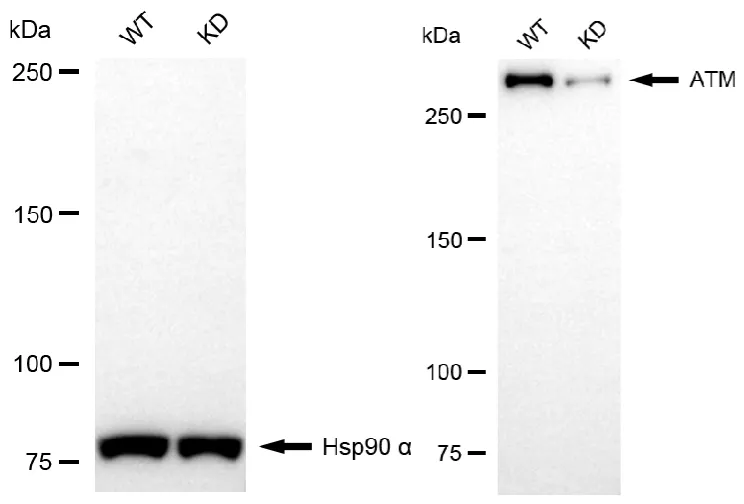 KD-Validated ATM Serine/Threonine Kinase Recombinant Rabbit Monoclonal Antibody