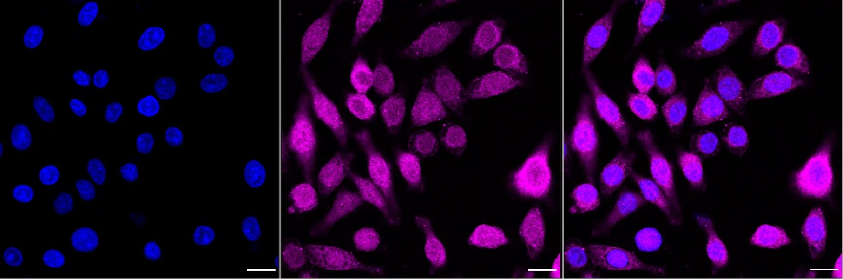 Immunocytochemistry(ICC) - KD-Validated Enolase 1 Recombinant Rabbit Monoclonal Antibody KVAb01441
