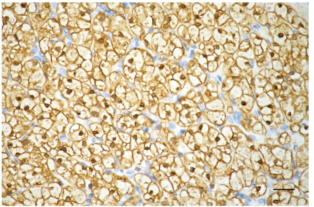 Immunohistochemistry(IHC) - KD-Validated Enolase 1 Recombinant Rabbit Monoclonal Antibody KVAb01441